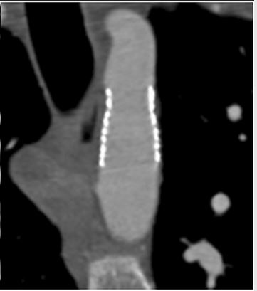 Fig 3d Boccalini et al Jan 2019