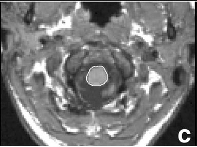 Fig1c Piaggio et al Nov