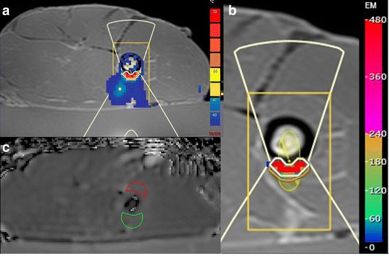 Fig2 Giles et al Nov
