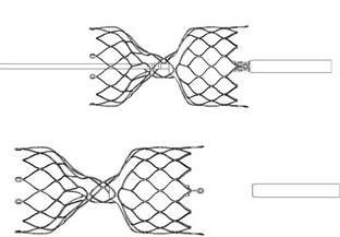Hughes et al_September 2018