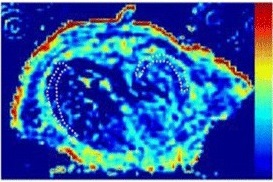Kenkel et al_September 2018