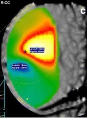 Petrillo et al_September 2018
