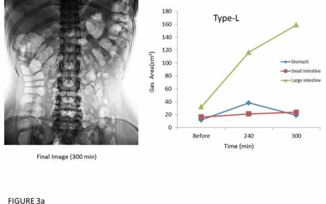Small intestinal bowel gas and breath hydrogen after ingestion of lactulose