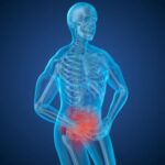 Low-dose CT with iterative reconstruction for acute abdominal pain