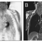 PET-MRI for cardiac imaging: statement from the ESCR and the EANM