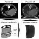 Building an anthropomorphic phantom with 3D printing for simulation in Intervention