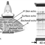 Sarcopenia: a new word we need to be familiar with!