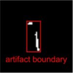 Copper-containing contraceptives are MR-friendly