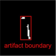 Copper-containing contraceptives are MR-friendly