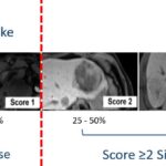 Reply to the Letter to the Editor: “Hepatocellular adenomas: is there additional value in using Gd-EOB-enhanced MRI for subtype differentiation?”