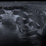 Improving your report on US of varicoceles