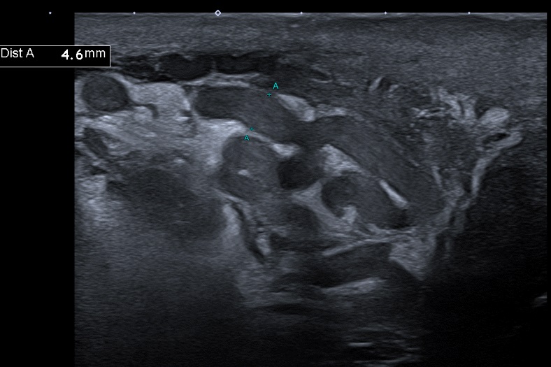 Improving your report on US of varicoceles