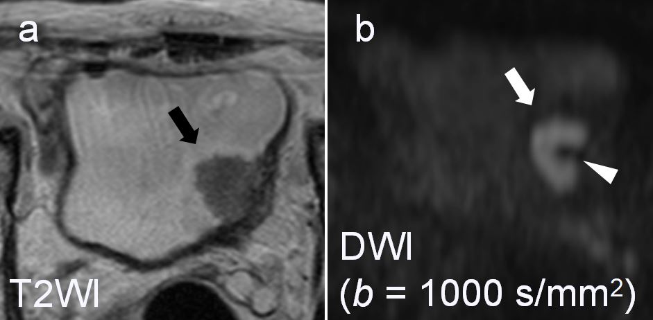 Do you know the Inchworm sign?
