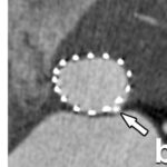 How should we do and report pre-TAVI/TAVR CT/MRI examinations?