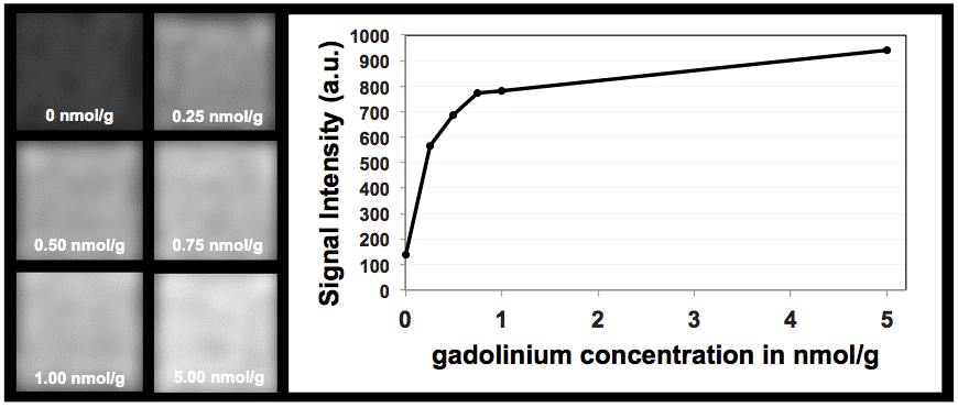 Reply to: Are all questions about the safety of MRI contrast agent answered?