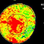 Predicting the unpredictable!