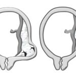 Placental imaging: a useful new horizon