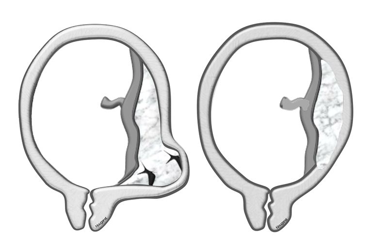 Placental imaging: a useful new horizon