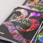 25th Anniversary Special Edition