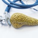 Chronic pancreatitis: “and the winner is…”