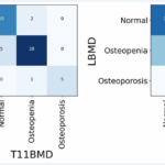 Letter to the Editor: “Proposed diagnostic volumetric bone mineral density thresholds for osteoporosis and osteopenia at the cervicothoracic spine in correlation to the lumbar spine”