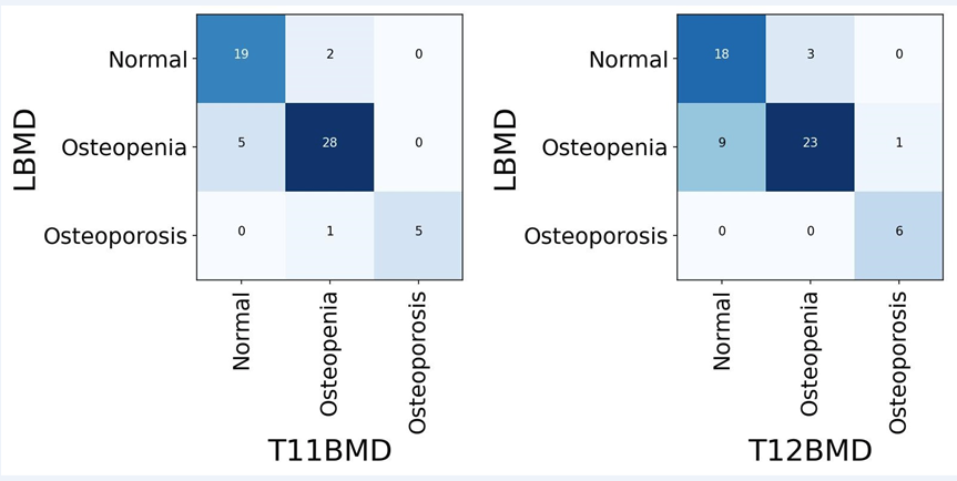 Letter to the Editor: “Proposed diagnostic volumetric bone mineral density thresholds for osteoporosis and osteopenia at the cervicothoracic spine in correlation to the lumbar spine”