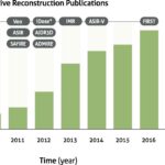 Understanding the huge advances in CT image reconstruction