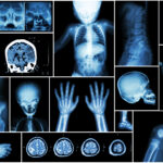 Postmortem fetal magnetic resonance imaging