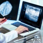 Mammography diagnosis performance under evaluation