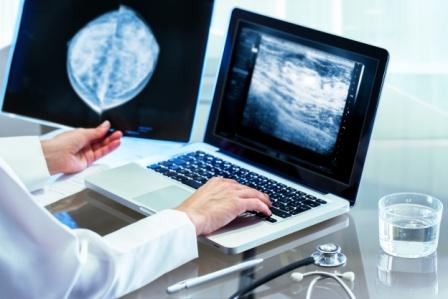 Mammography diagnosis performance under evaluation
