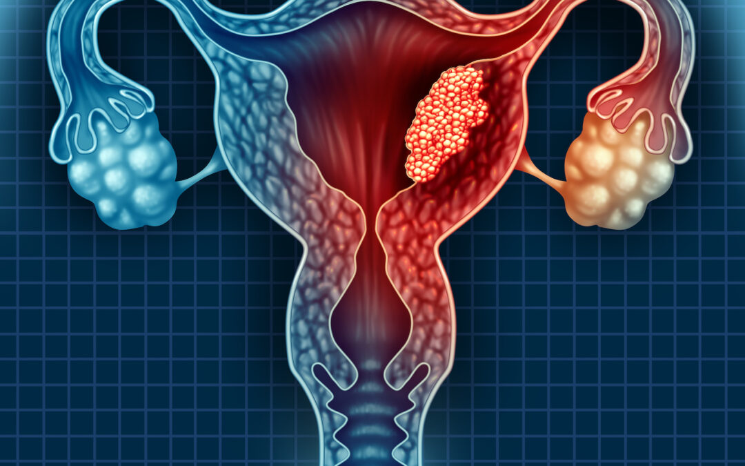 Endometrial and cervical cancer
