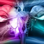 MRI for the evaluation of adenomyosis