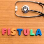 Management of perianal Crohn’s disease