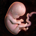 Enteric duplication cysts in children: varied presentations, varied imaging findings