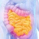 The importance of enterocutaneous fistulas imaging