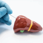 An overview of liver segmentation